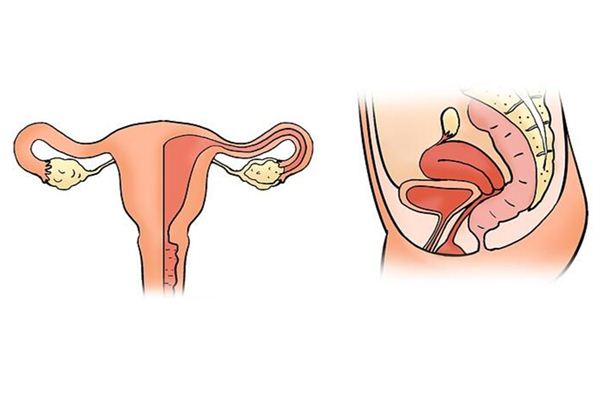 significado dos sonhos uterinos