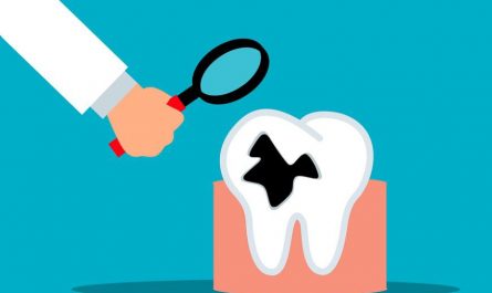 11 Significados de Sonhar com Dentes Podres