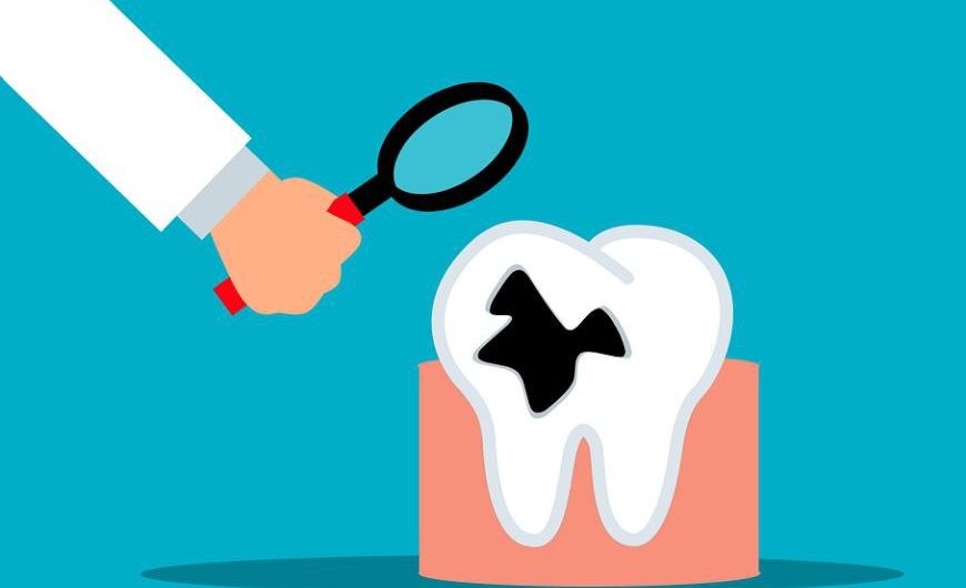 11 Significados de Sonhar com Dentes Podres