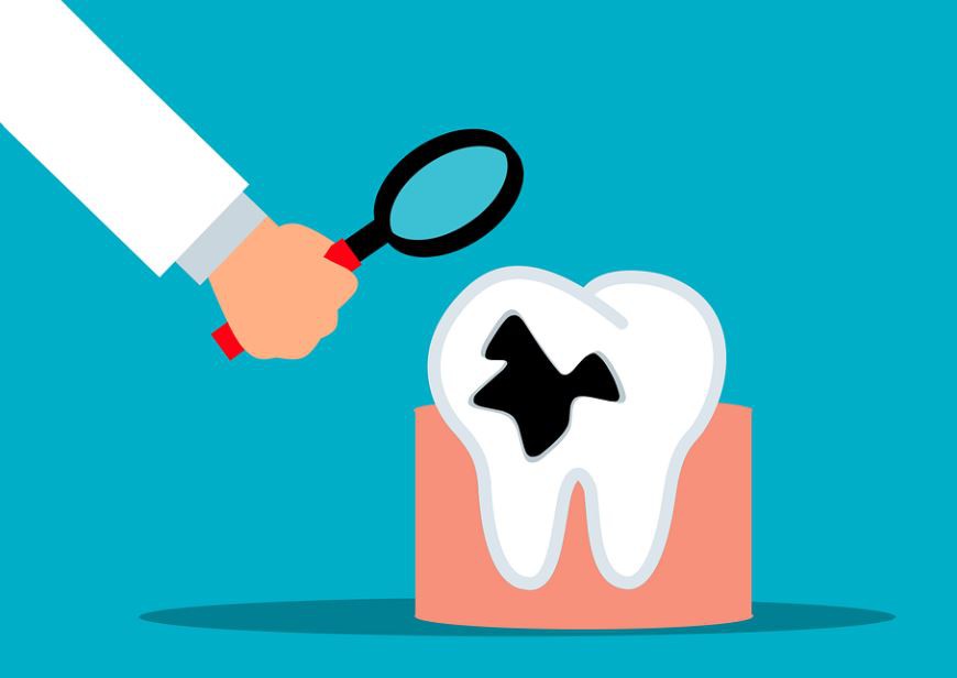 11 Significados de Sonhar com Dentes Podres