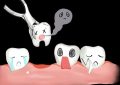 16 Significados dos Sonhos com Extração Dentária