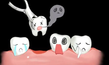 16 Significados dos Sonhos com Extração Dentária