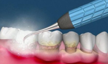 12 Significados de Sonhar com Limpeza dos Dentes