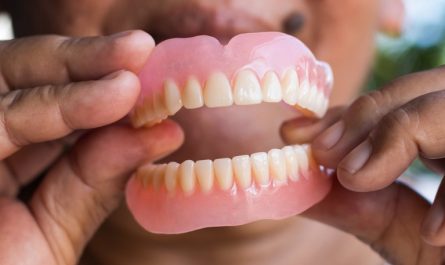 16 Significados de Sonhar com Dentaduras