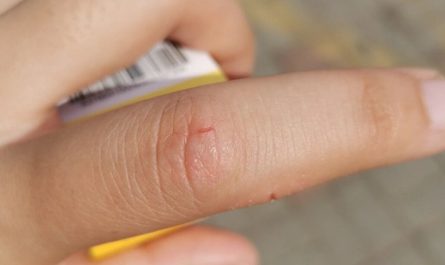 28 Significados de Sonhar com um Dedo Ferido