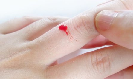18 Significados de Sonhar com Dedos a Sangrar