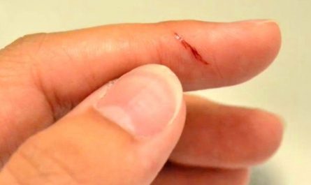 14 Significados de Sonhar que Cortou o Dedo